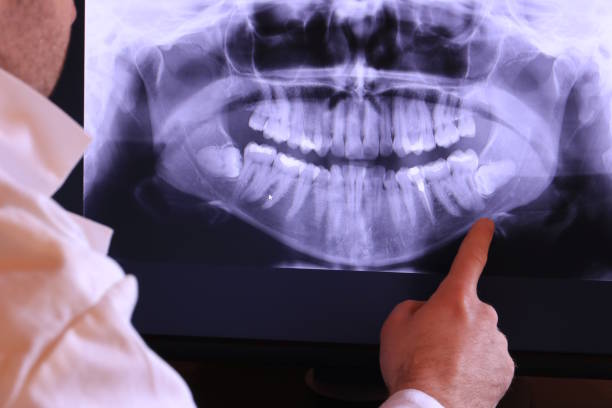 Best Weekend Emergency Dentist in Kingston, TN